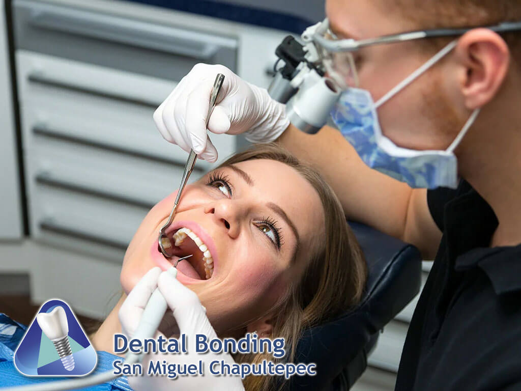 Dental Bonding San Miguel Chapultepec