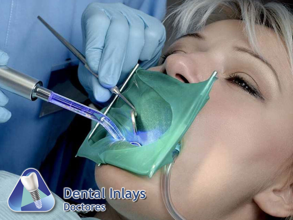 Dental Inlays Col. Doctores
