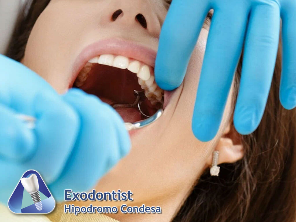 Exodontist Hipódromo Condesa