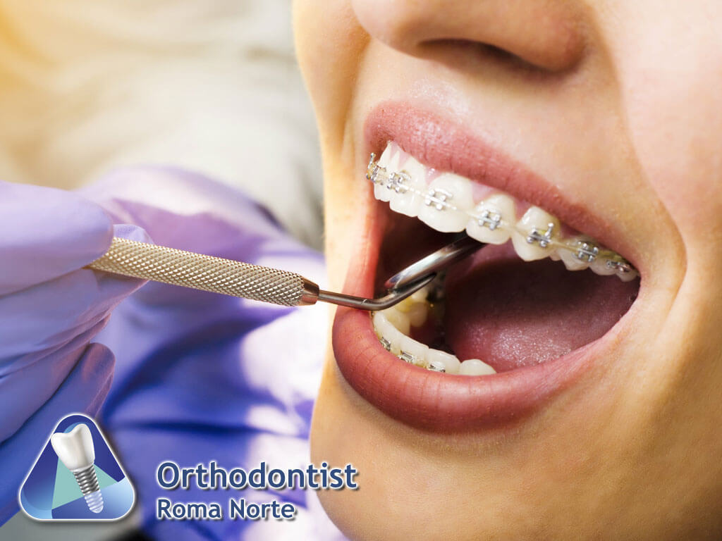 Orthodontist Roma Norte