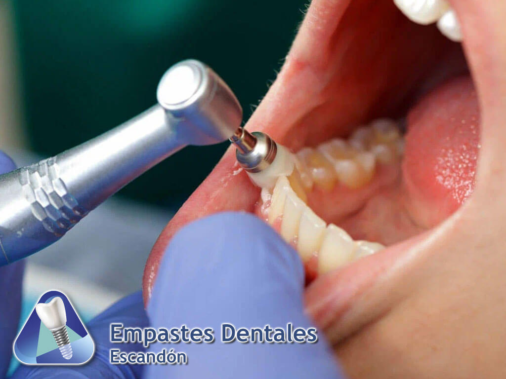 Empastes Dentales Escandón