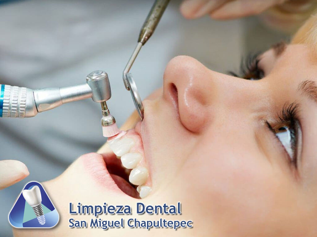 Limpieza Dental San Miguel Chapultepec
