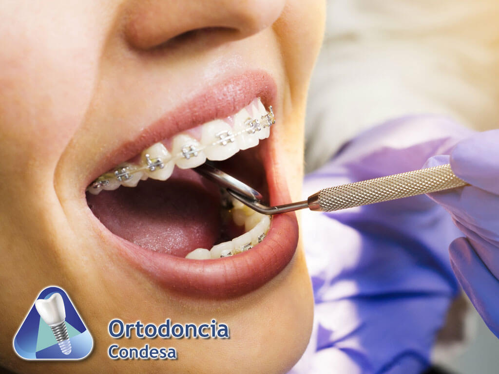 Ortodoncia Condesa