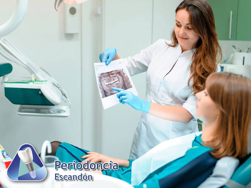 Periodoncia Escandón